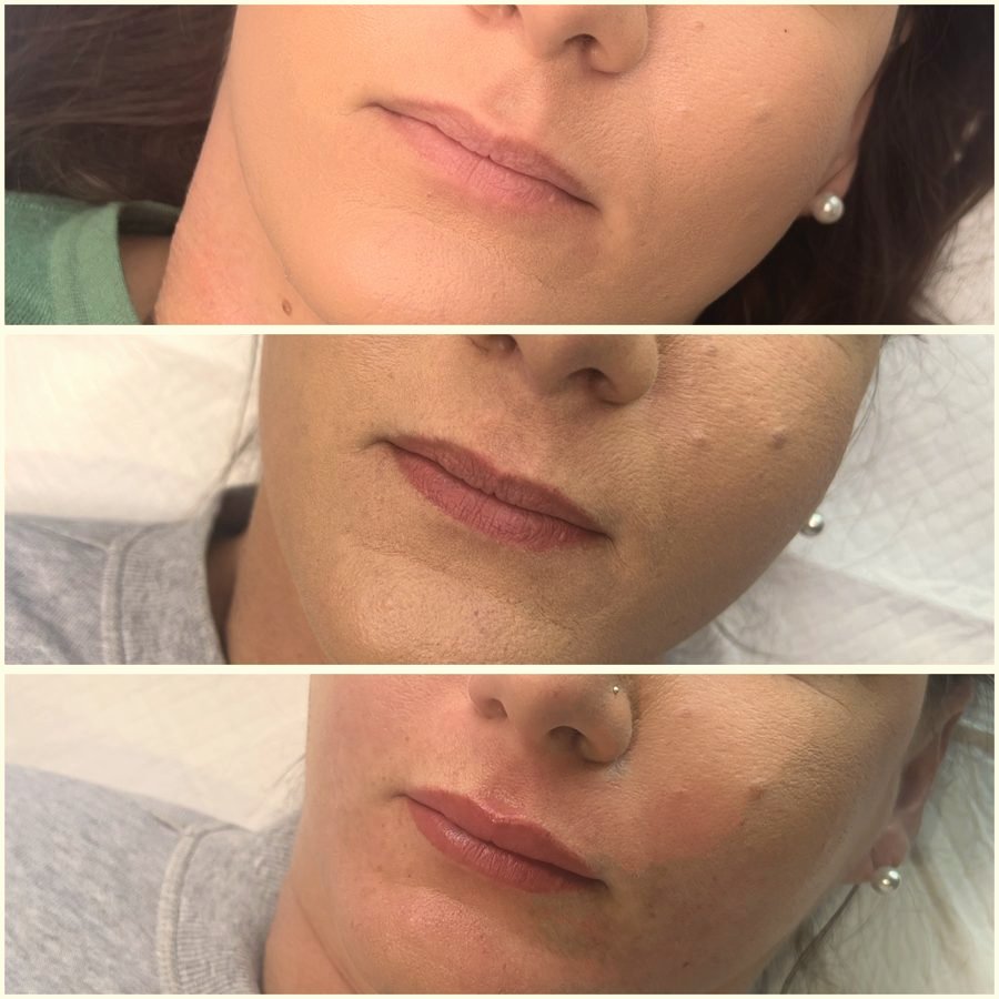 Lip blushing before and after result
