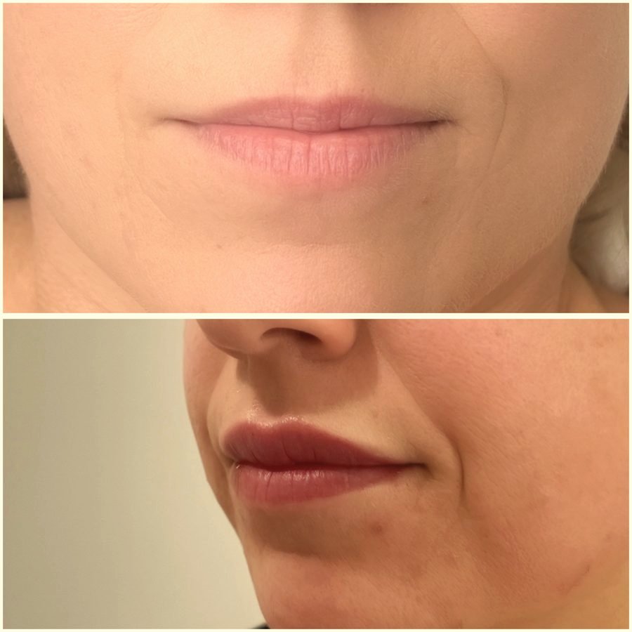 Lip blushing before and after result