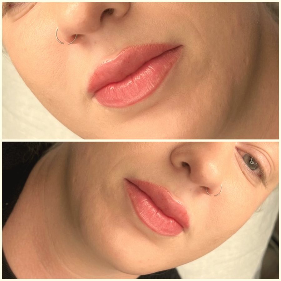 Healed lip blush result, soft natural tone