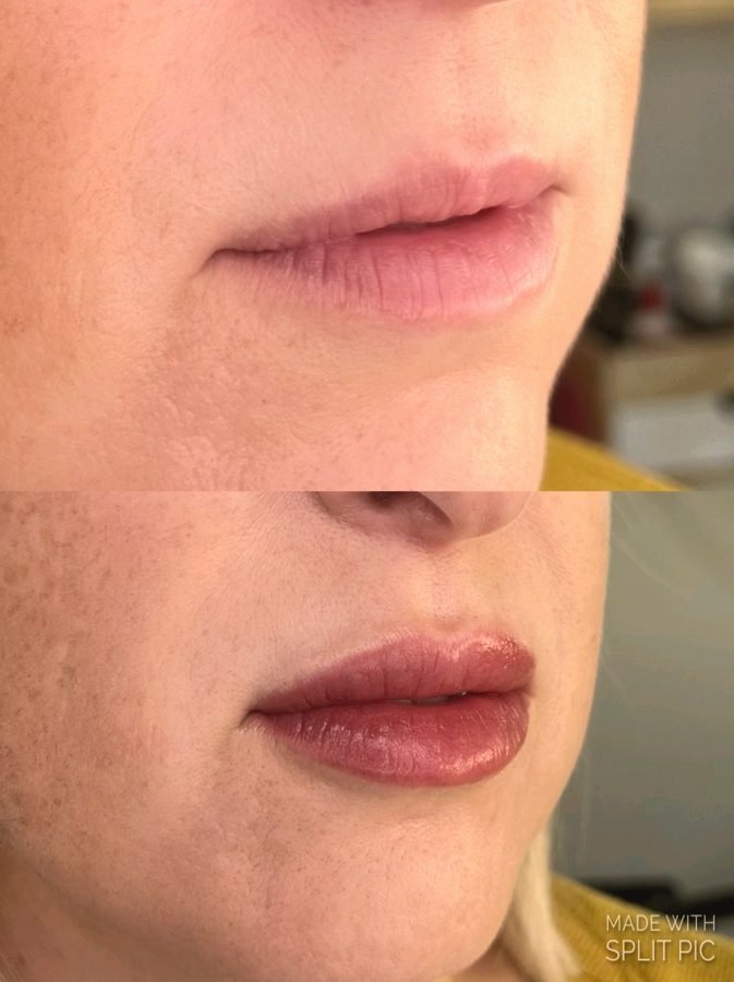 Lip blushing before and after side profile