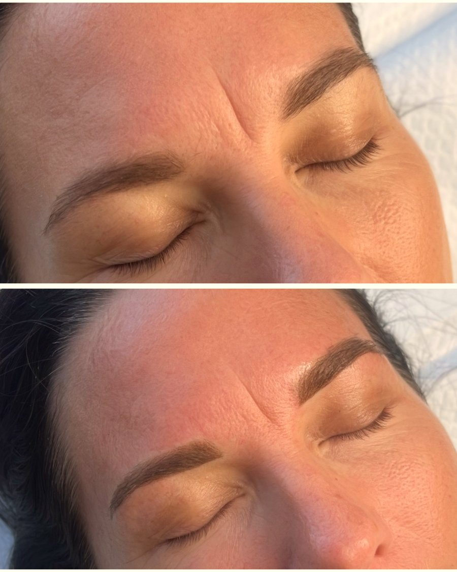 Eyebrow cosmetic tattoo before and after healed result